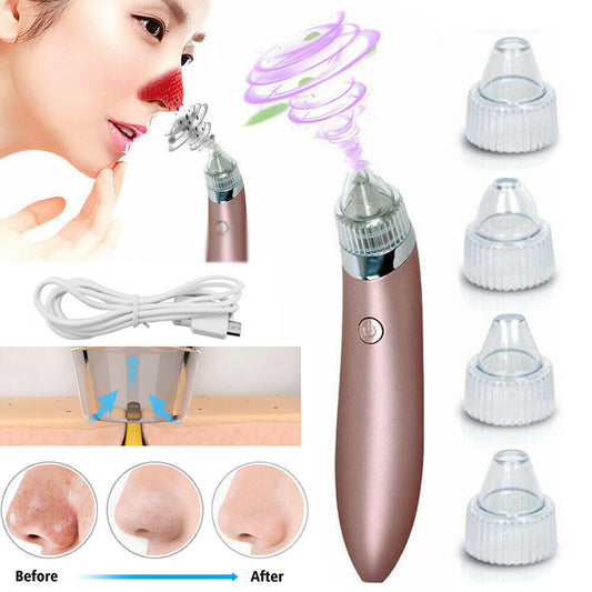 Electric Blackhead Vacuum Pore Cleaner Acne Pimple Remover