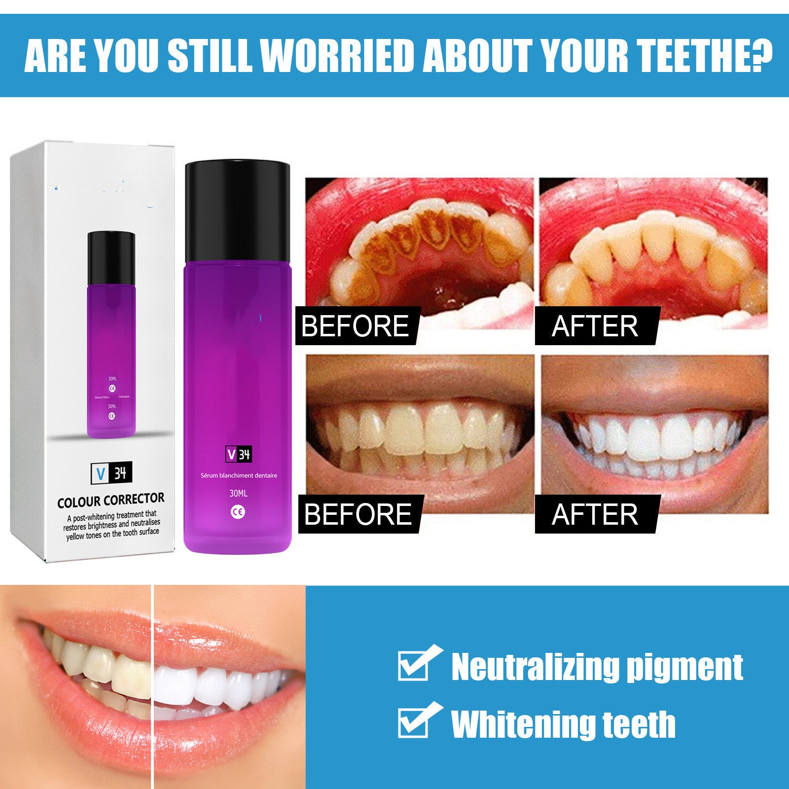 Teeth Whitening Liquid Toothpaste Tooth Stain Removal Oral Care Beauty dealsniper-net