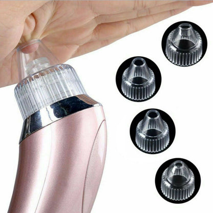 Electric Blackhead Vacuum Pore Cleaner Acne Pimple Remover