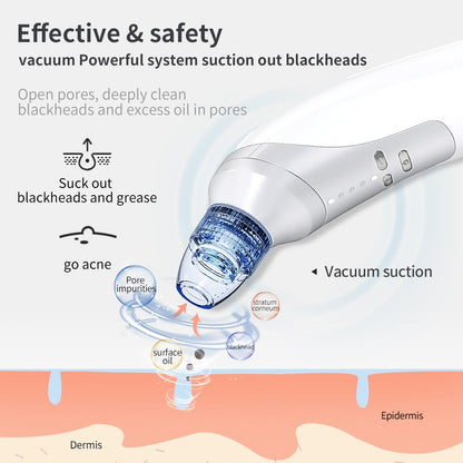 The Main Features Of The Acne Suction Tool Are That It Can