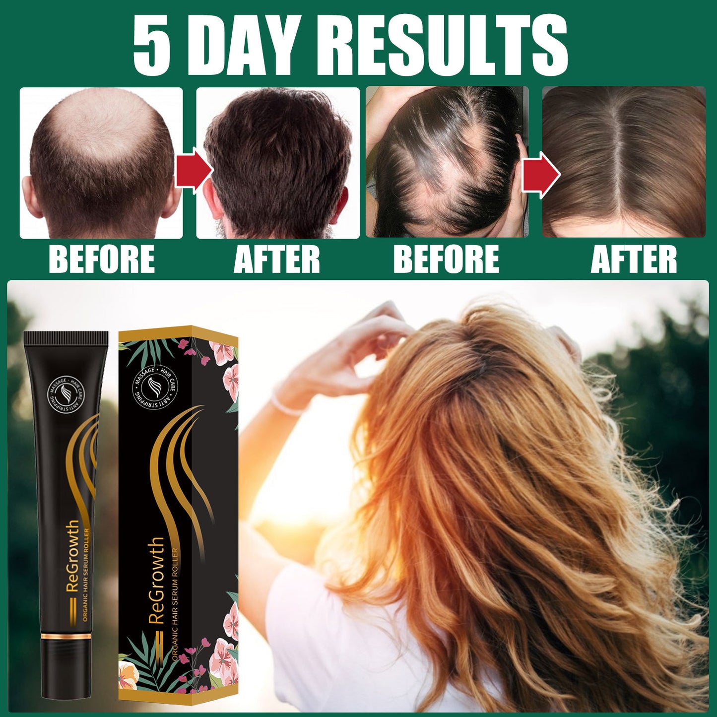 Regrowth Organic Hair Serum Roller Set Hair Care Anti Stripping Deals dealsniper-net