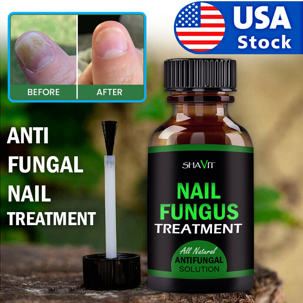 Toenail And Fingernail Fungus Treatment Extra Strength Antifungal Athletes Foot Health DealSniper.net
